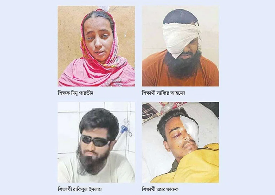 চক্ষুবিজ্ঞান ইনস্টিটিউট ও হাসপাতাল | আন্দোলনে গুলিতে চোখ নষ্ট ৪০১ জনের